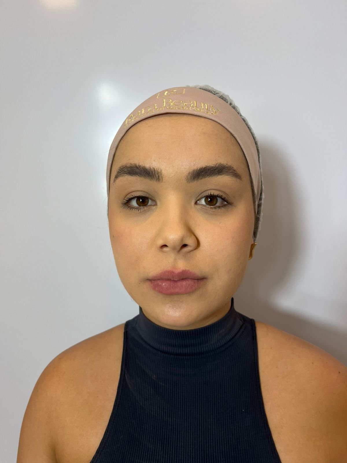 Antes do Procedimento